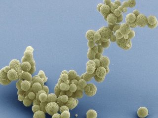 Ilmuwan Berhasil Menciptakan Bakteri Sintetik