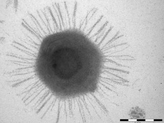 MIMIVIRUS & MAMAVIRUS: Mengenal Keberadaan Virus Raksasa Pada Sistem Kehidupan