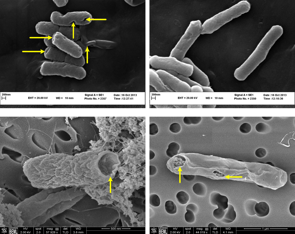 hantu bakteri E. coli 